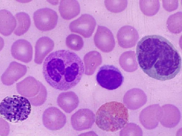 淋巴细胞（lymphocyte）