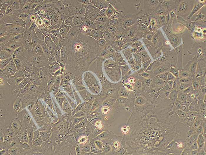 HuCCT1细胞图片