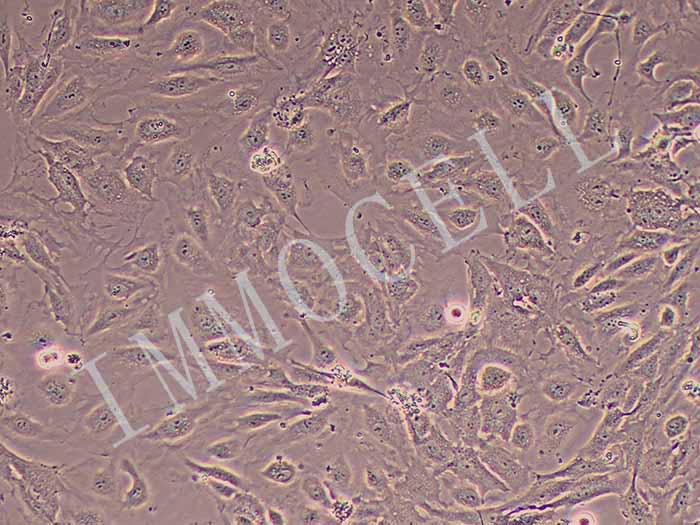 人肝窦细胞图片