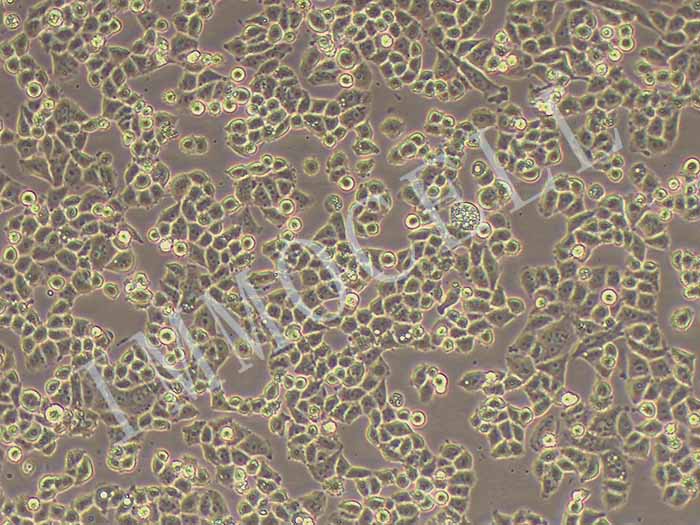NCI-H1703-LUC细胞图片