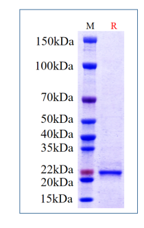 Human FGF-19, His Tag on SDS-PAGE under reducing (R) condition