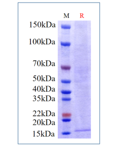 Human IL-2, His Tag on SDS-PAGE under reducing (R) condition