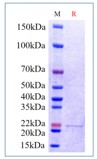 Human IL-21, His Tag on SDS-PAGE under reducing (R) condition