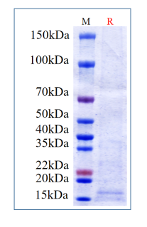 Human IL-3, His Tag on SDS-PAGE under reducing (R) condition