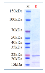 Human IL-10, His Tag on SDS-PAGE under reducing (R) condition