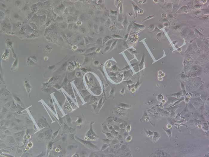 Calu-1-LUC-EGFP细胞图片