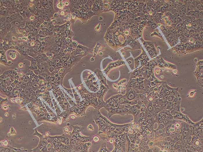 Capan-1-LUC细胞图片