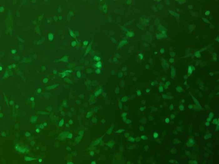 MKN-28-LUC-EGFP（人胃癌细胞-荧光素酶标记-绿色荧光蛋白（STR鉴定正确））