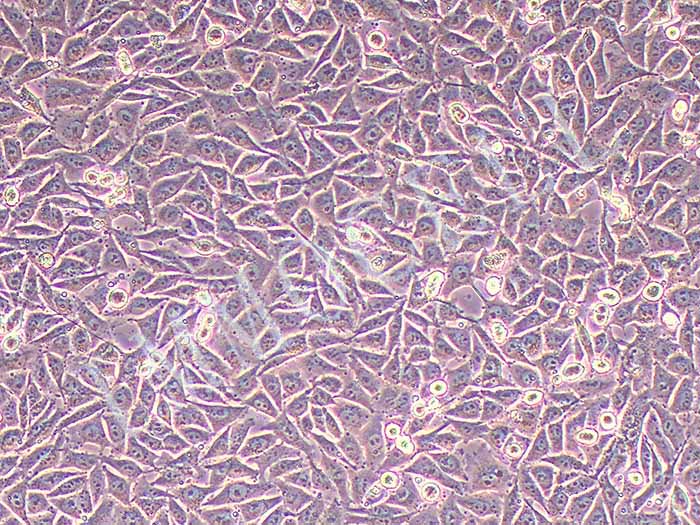 A375-LUC-EGFP（人恶性黑色素瘤细胞-荧光素酶标记-绿色荧光标记（STR鉴定正确））
