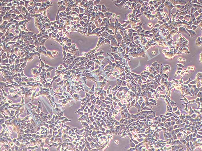 PC3-LUC-EGFP细胞图片