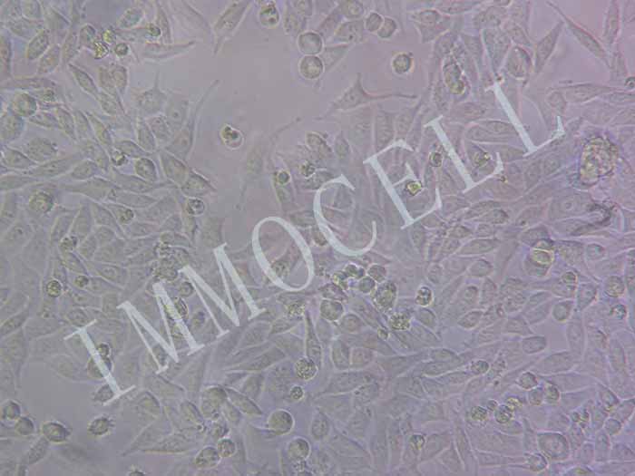RKO-luc-EGFP细胞图片