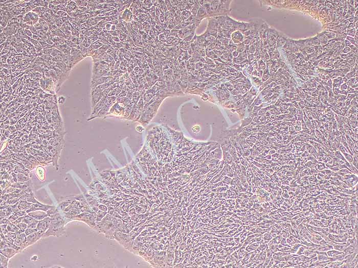 RT4细胞(人膀胱移行细胞乳头瘤细胞)(STR鉴定)-逸漠细胞库