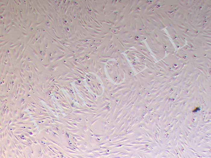 人乳腺癌成纤维细胞永生化图片