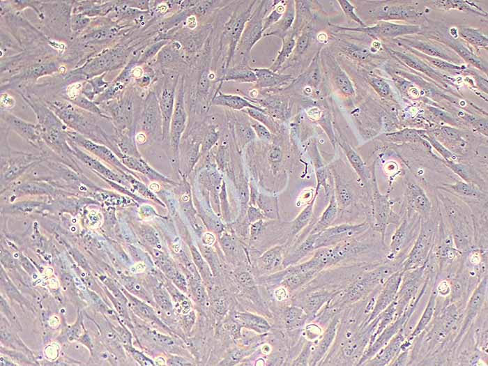人乳腺癌成纤维细胞永生化图片