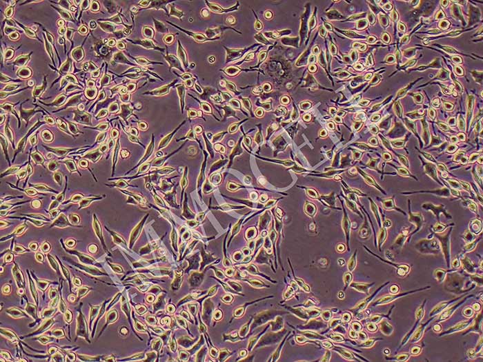 RBL-2H3大鼠嗜碱性白血病细胞图片