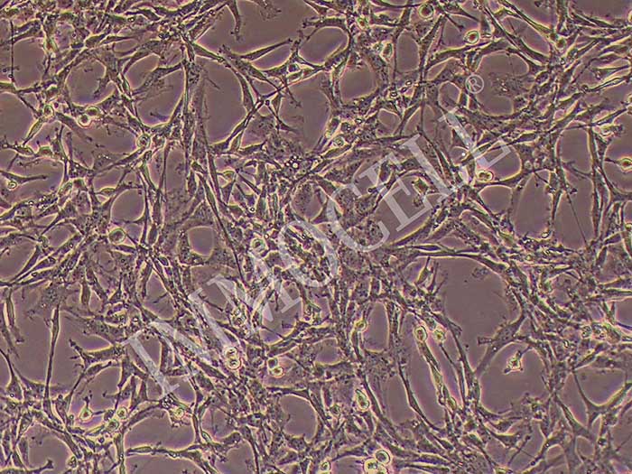 脑微血管内皮细胞细胞图片