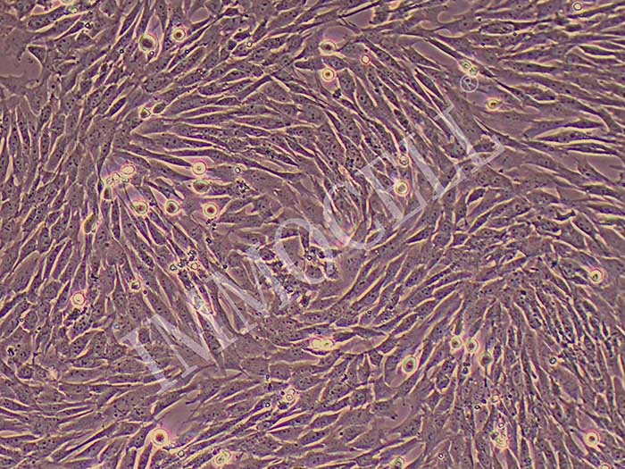 小鼠肝星状细胞细胞图片
