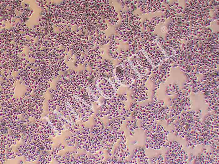 SK-CO-1，人结直肠腺癌细胞
