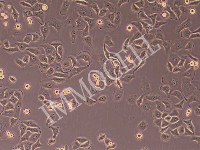 人宫颈癌细胞图片