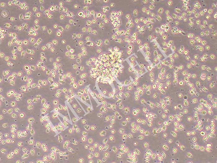 GM12878人B淋巴细胞