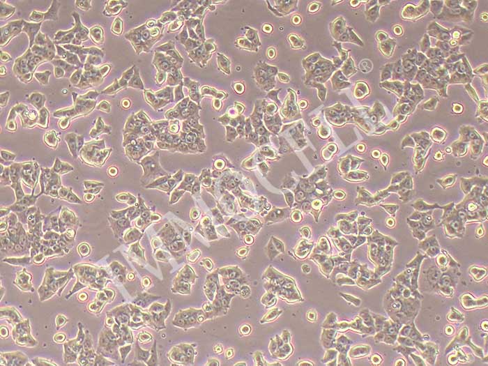 HCC-1833细胞图片