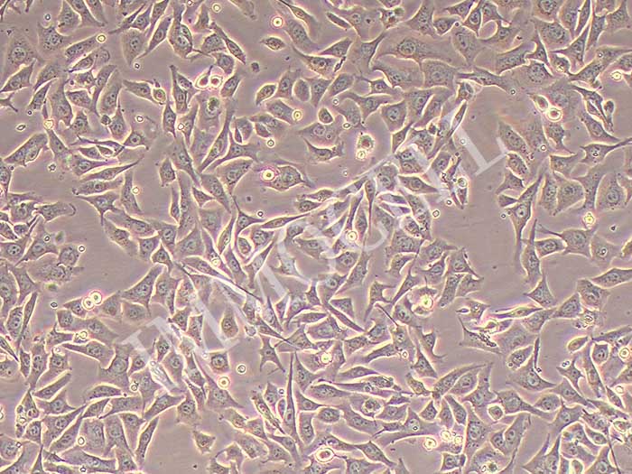 B16F10-LUC细胞图片