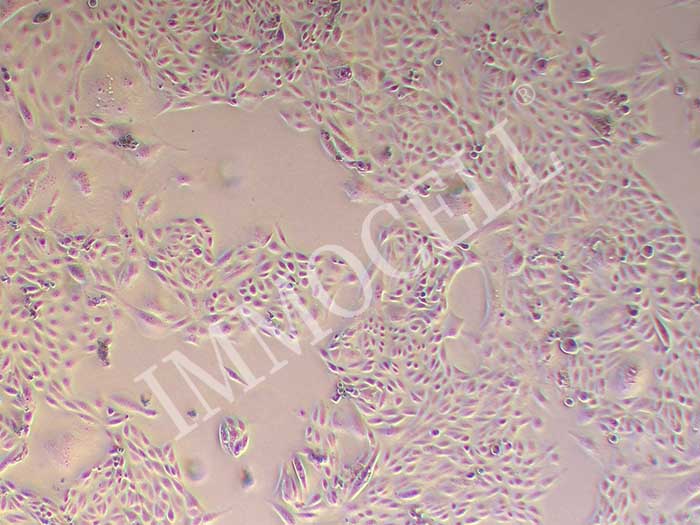 COV362人卵巢癌细胞