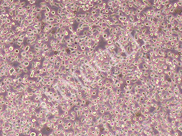 NCI-H929细胞图片