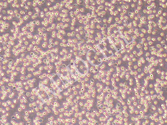 OCI-AML-2细胞图片