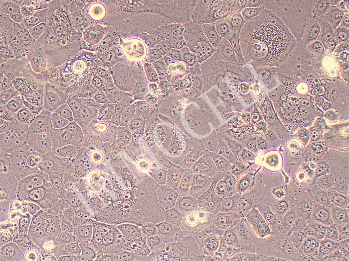 SCC47细胞细胞图片