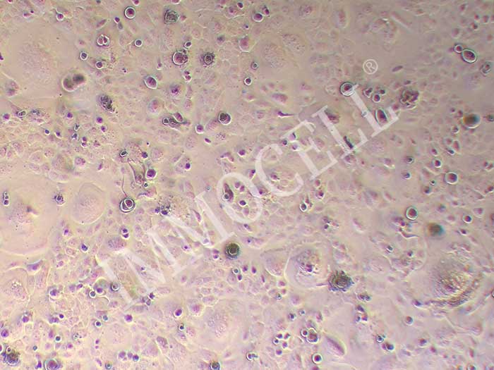 SCC47细胞图片