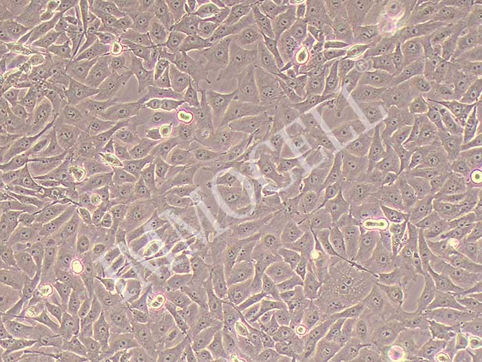 NPCHK-1人鼻咽癌细胞细胞图片