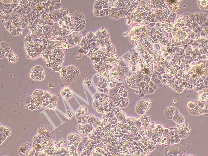QGP-1人胰腺癌细胞