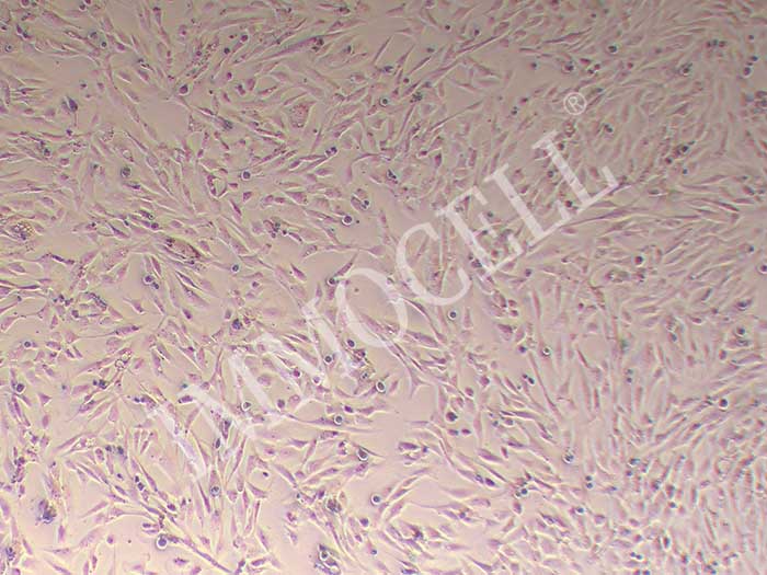 HUVSMC人脐静脉平滑肌细胞图片