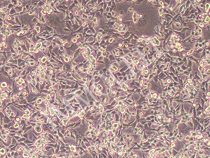MC38细胞细胞图片