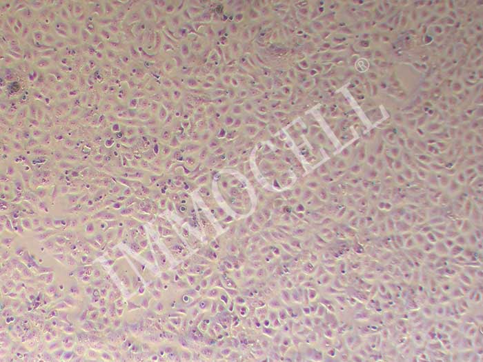 TU686细胞图片