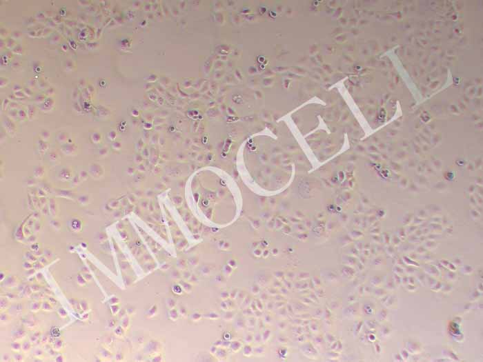 HCC1937细胞图片
