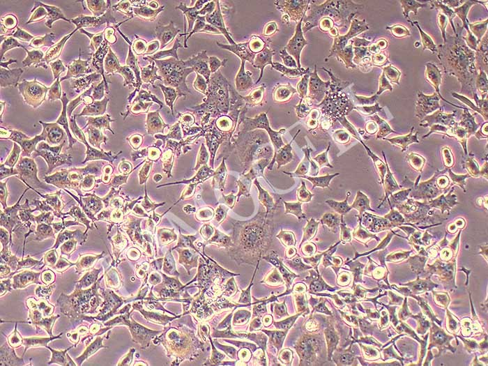 Hs-746T细胞细胞图片