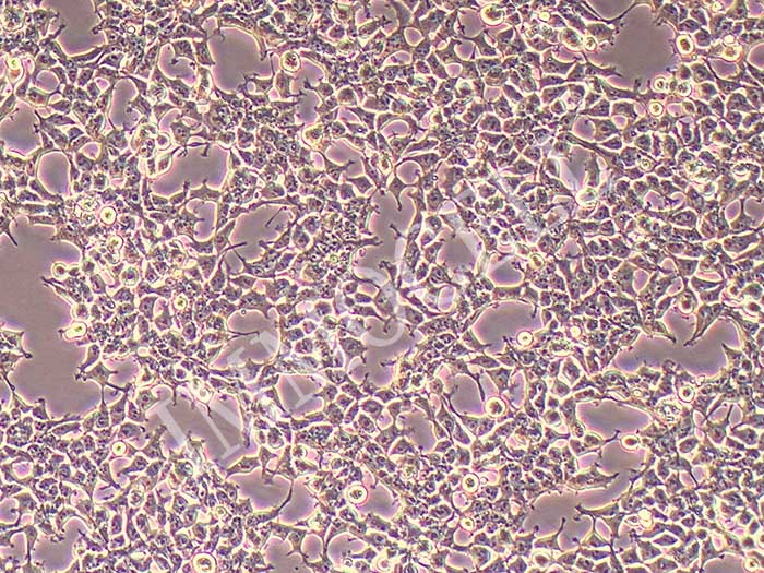 Lentix293细胞细胞图片