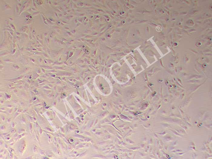 SNU475人肝癌细胞图片
