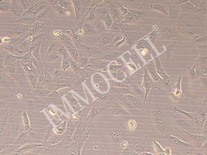 SNU475人肝癌细胞图片