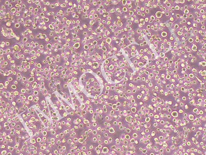 OCI-AML3人急性髓细胞性白血病细胞图片