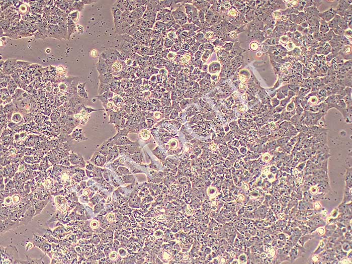 A-67细胞细胞图片