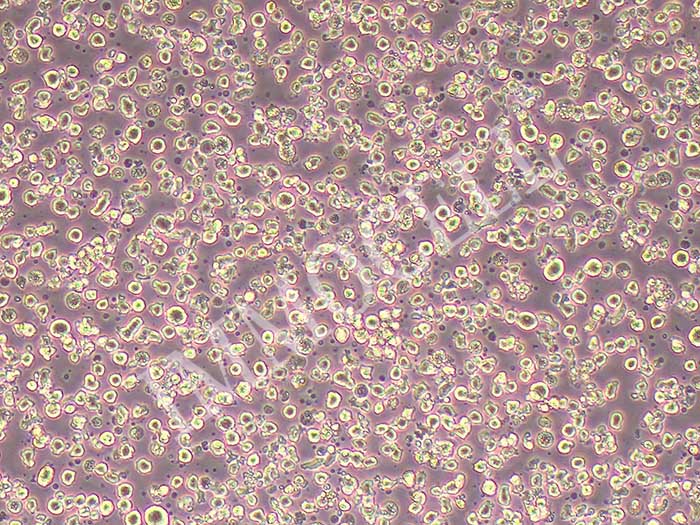 H9/HTLV-IIIB细胞图片