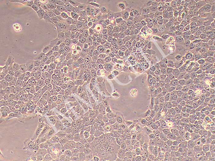 HBE135-E6E7细胞图片