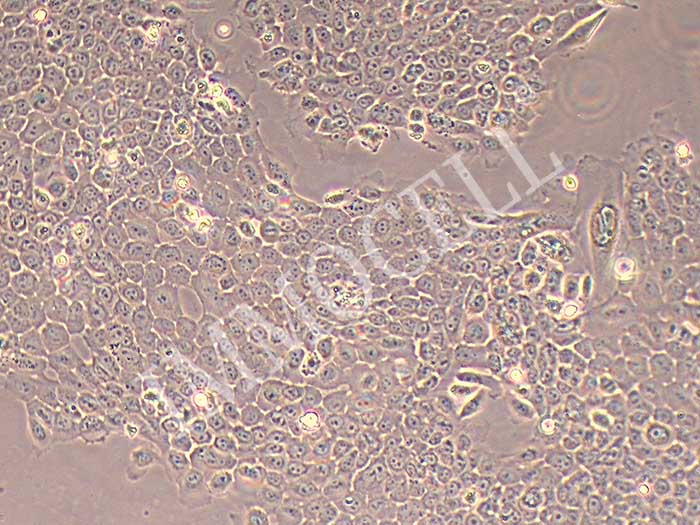 HBE135-E6E7细胞图片
