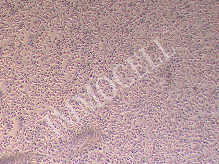 JIMT-1人乳腺癌细胞图片