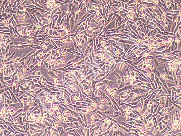 JIMT-1人乳腺癌细胞图片