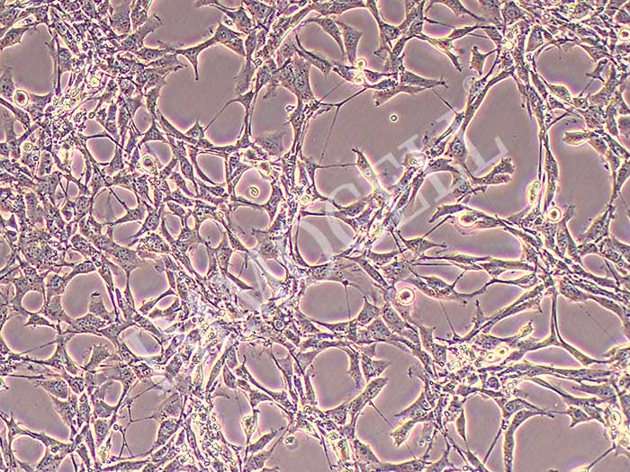 MS-5小鼠骨髓基质细胞图片