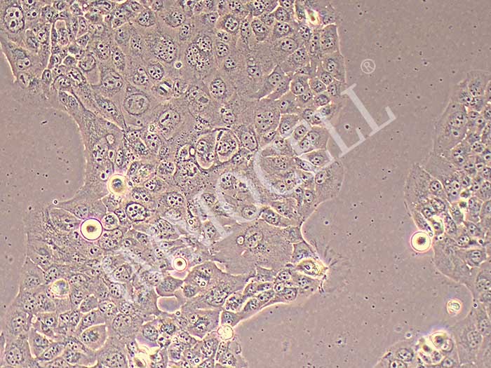 NCI-H441人肺腺癌细胞细胞图片